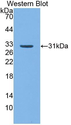 Polyclonal Antibody to Cluster Of Differentiation 109 (CD109)