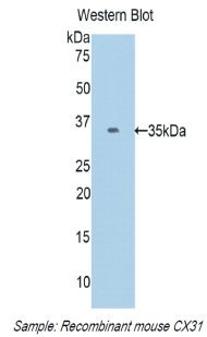 Polyclonal Antibody to Connexin 31 (CX31)