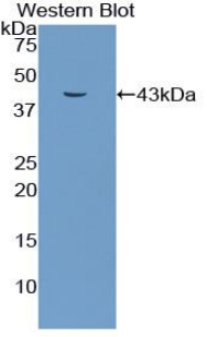 Polyclonal Antibody to Connexin 31 (CX31)