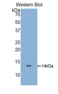 Polyclonal Antibody to Colony Stimulating Factor Receptor, Granulocyte (GCSFR)