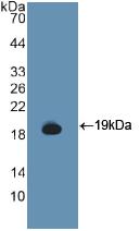 Polyclonal Antibody to Colony Stimulating Factor Receptor, Granulocyte (GCSFR)