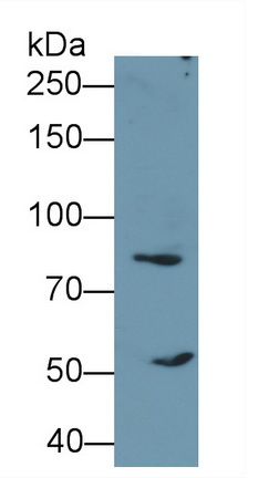 Polyclonal Antibody to Colony Stimulating Factor Receptor, Granulocyte (GCSFR)