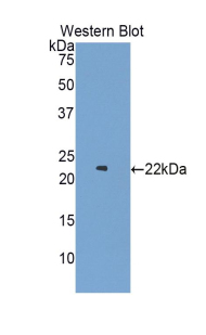 Polyclonal Antibody to Colony Stimulating Factor Receptor, Granulocyte (GCSFR)