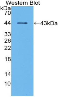 Polyclonal Antibody to Matrix Gla Protein (MGP)