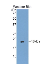 Polyclonal Antibody to Matrix Gla Protein (MGP)