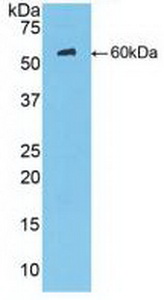 Polyclonal Antibody to Mannose Binding Lectin (MBL)