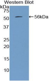 Polyclonal Antibody to Mannose Binding Lectin (MBL)