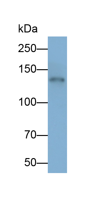 Polyclonal Antibody to N-cadherin (NCAD)