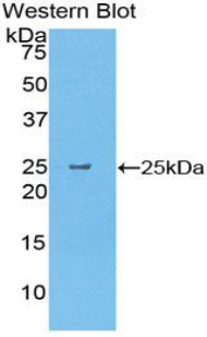 Polyclonal Antibody to Pancreatic Elastase 1 (ELA1)