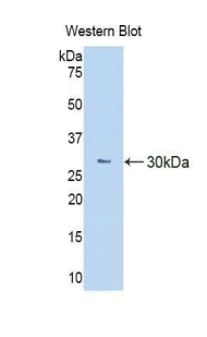 Polyclonal Antibody to Colony Stimulating Factor Receptor, Macrophage (MCSFR)