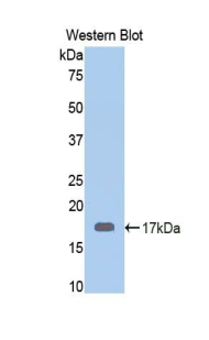 Polyclonal Antibody to Calreticulin (CALR)