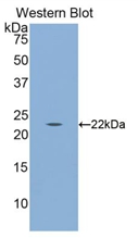 Biotin-Linked Polyclonal Antibody to Calreticulin (CALR)