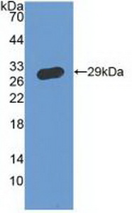 Polyclonal Antibody to Interferon Gamma Receptor 1 (IFNgR1)