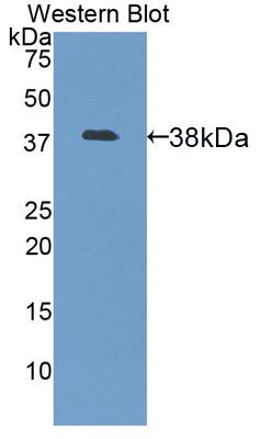 Polyclonal Antibody to Lumican (LUM)