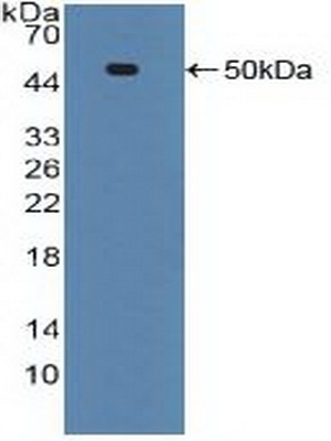 Polyclonal Antibody to Tumor Necrosis Factor Receptor 1 (TNFR1)