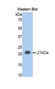 Polyclonal Antibody to Tumor Necrosis Factor Receptor 1 (TNFR1)