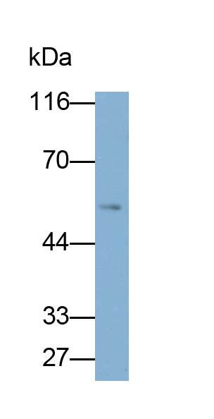 Polyclonal Antibody to Tumor Necrosis Factor Receptor 1 (TNFR1)