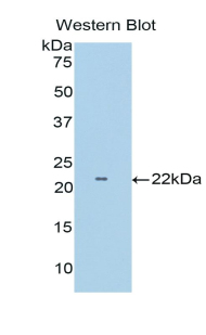 Polyclonal Antibody to Tumor Necrosis Factor Receptor Superfamily, Member 1B (TNFRSF1B)