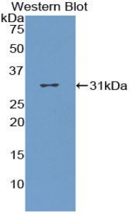 Polyclonal Antibody to Cluster Of Differentiation 36 (CD36)