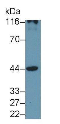 Polyclonal Antibody to Cluster Of Differentiation 147 (CD147)