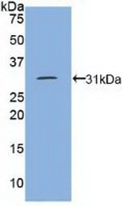 Polyclonal Antibody to Density Enhanced Phosphatase 1 (DEP1)