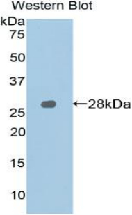 Polyclonal Antibody to Signaling Lymphocytic Activation Molecule Family, Member 1 (SLAMF1)