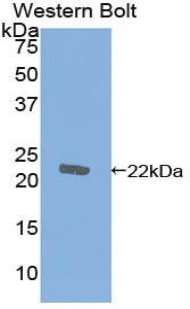 Polyclonal Antibody to Cofilin 1 (CFL1)