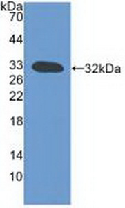 Polyclonal Antibody to Lymphotoxin Beta (LTb)