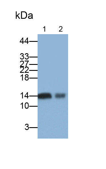 Polyclonal Antibody to Fatty Acid Binding Protein 1 (FABP1)