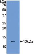 Polyclonal Antibody to Fatty Acid Binding Protein 1 (FABP1)