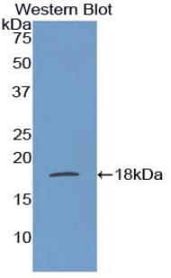 Polyclonal Antibody to Fatty Acid Binding Protein 1 (FABP1)