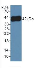 Polyclonal Antibody to Platelet Factor 4 Variant 1 (PF4V1)