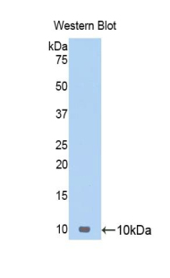 Polyclonal Antibody to Thymus Activation Regulated Chemokine (TARC)