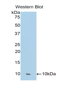 Polyclonal Antibody to Thymus Activation Regulated Chemokine (TARC)