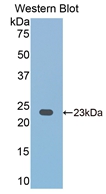 Polyclonal Antibody to Cluster Of Differentiation 2 (CD2)