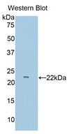 Polyclonal Antibody to Cluster Of Differentiation 2 (CD2)