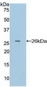 Polyclonal Antibody to Cluster Of Differentiation 64 (CD64)