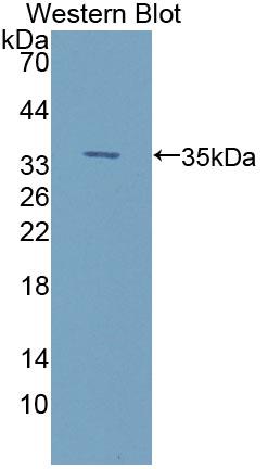 Polyclonal Antibody to Integrin Linked Kinase (ILK)