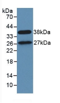 Polyclonal Antibody to Signal Transducing Adaptor Molecule 1 (STAM1)