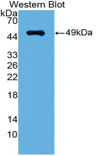 Polyclonal Antibody to Interferon Regulatory Factor 3 (IRF3)