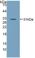 Polyclonal Antibody to Palladin (PALLD)