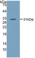 Polyclonal Antibody to Palladin (PALLD)