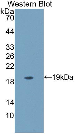 Polyclonal Antibody to Cluster Of Differentiation 164 (C<b>D164</b>)