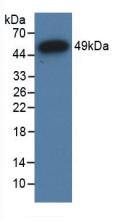 Polyclonal Antibody to Glucocorticoid Receptor (GR)