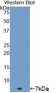 Polyclonal Antibody to Thymosin Beta 4 (TMSB4X)