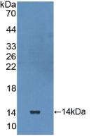 Polyclonal Antibody to Interleukin 10 Receptor Alpha (IL10Ra)