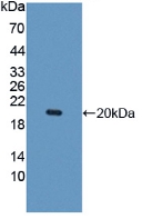 Polyclonal Antibody to Interleukin 10 Receptor Beta (IL10Rb)
