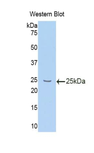 Polyclonal Antibody to Interleukin 10 Receptor Beta (IL10Rb)