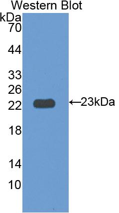 Polyclonal Antibody to Interleukin 12 Receptor Beta 1 (IL12Rb1)