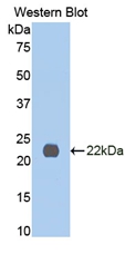 Polyclonal Antibody to Interleukin 13 Receptor Alpha 1 (IL13Ra1)